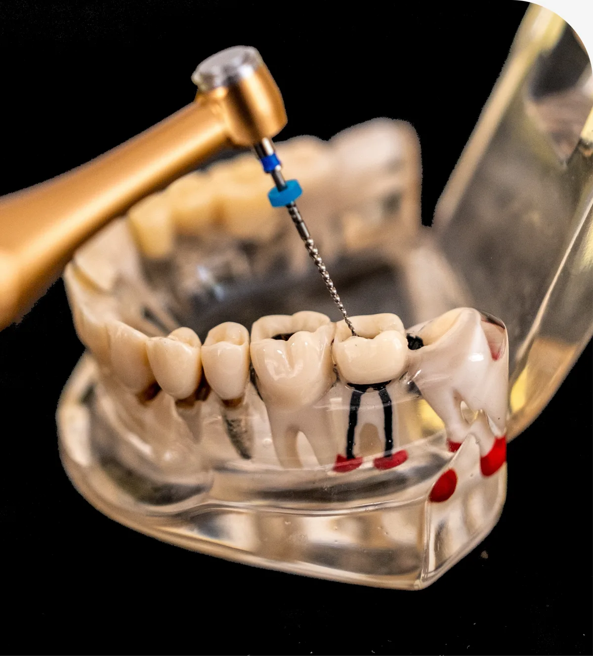 Why Choose Our Office - Tooth Extractions in Dallas, TX
